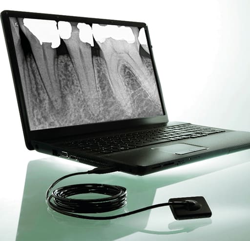 Carestream Kodak Rvg 5200 Digital Radiography System