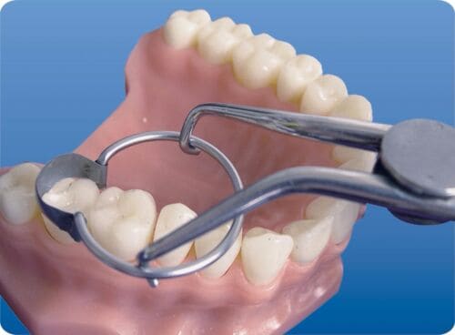 Tor Vm Rings