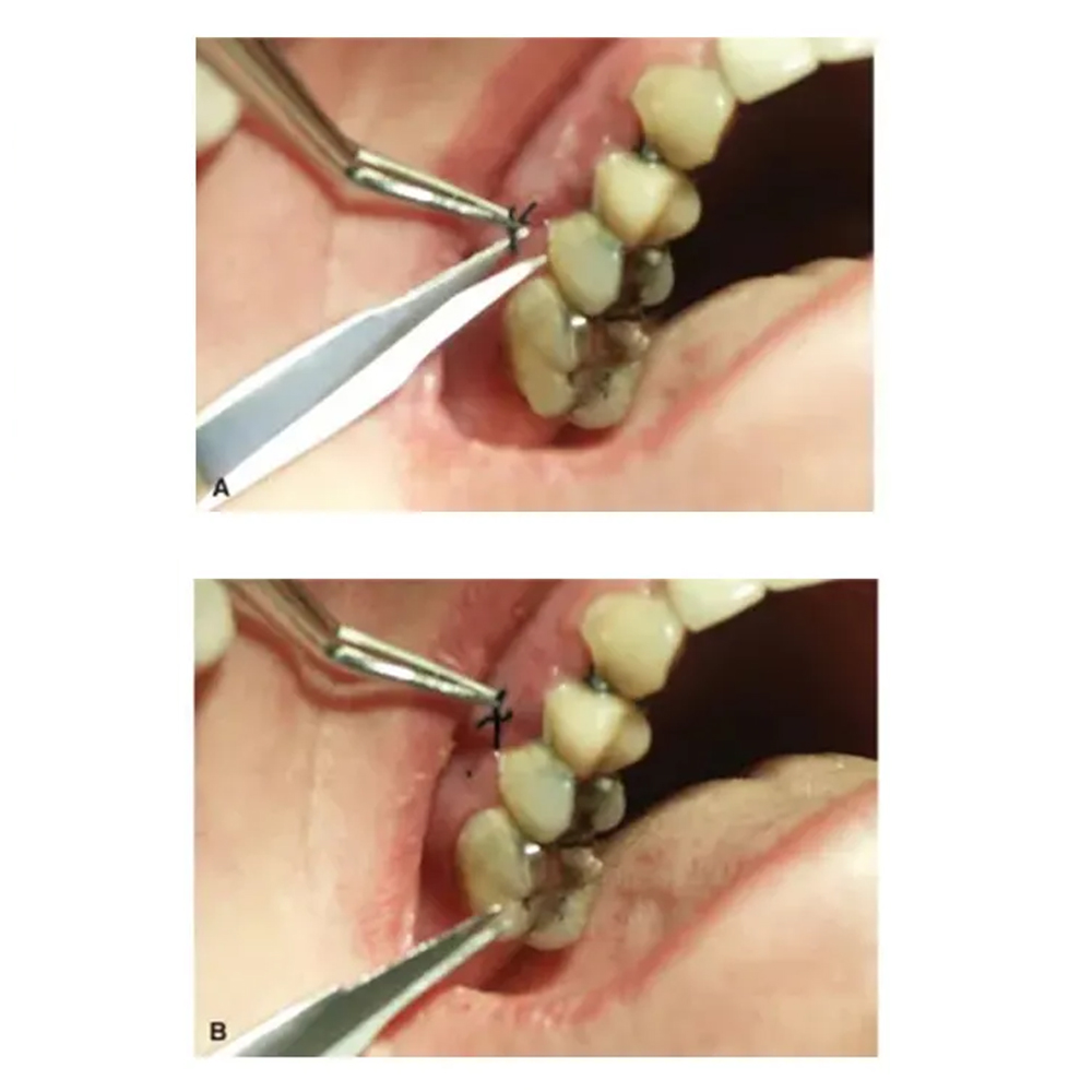 GDC Scissor Goldman Fox Straight Standard 13cm (S16)