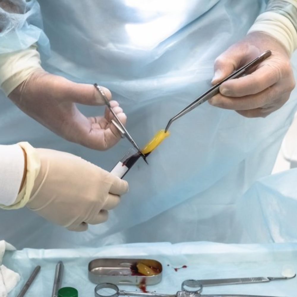 GDC Scissors Micro Iris - Straight (S26)