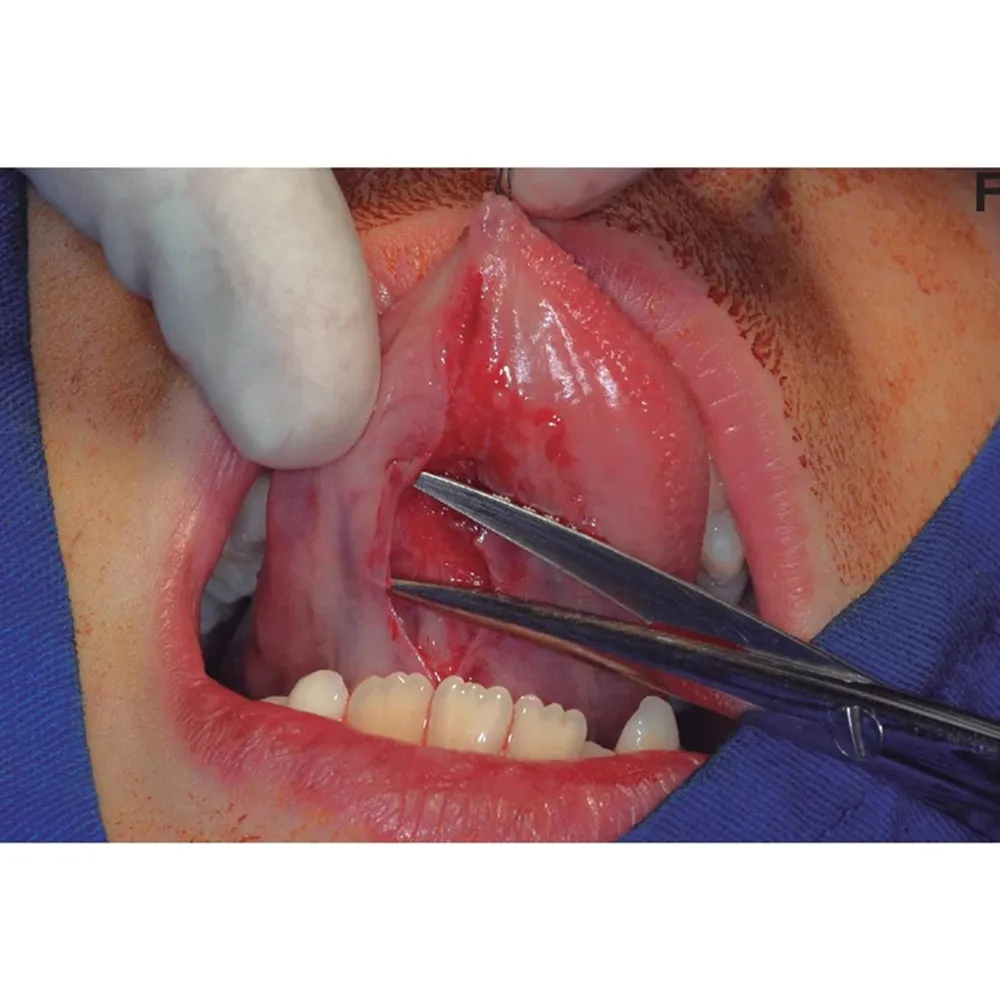 GDC Scissors Micro Iris - Curved (S26c)