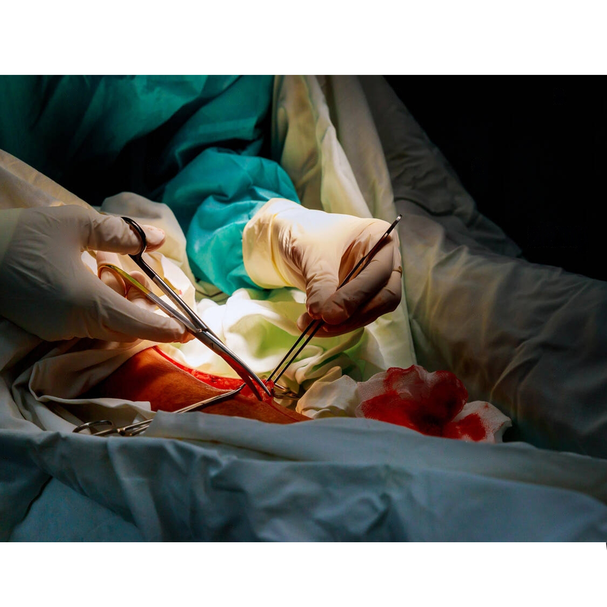 GDC Scissors Iris Tc - Curved (11.5cm) (S5083)