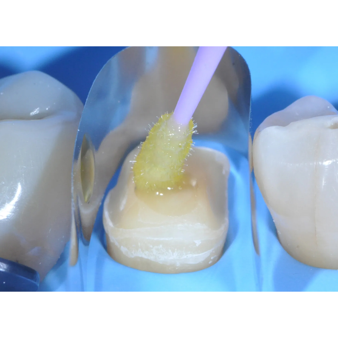 Kuraray Clearfil TRI-S Bond Universal Quick Bonding Agent