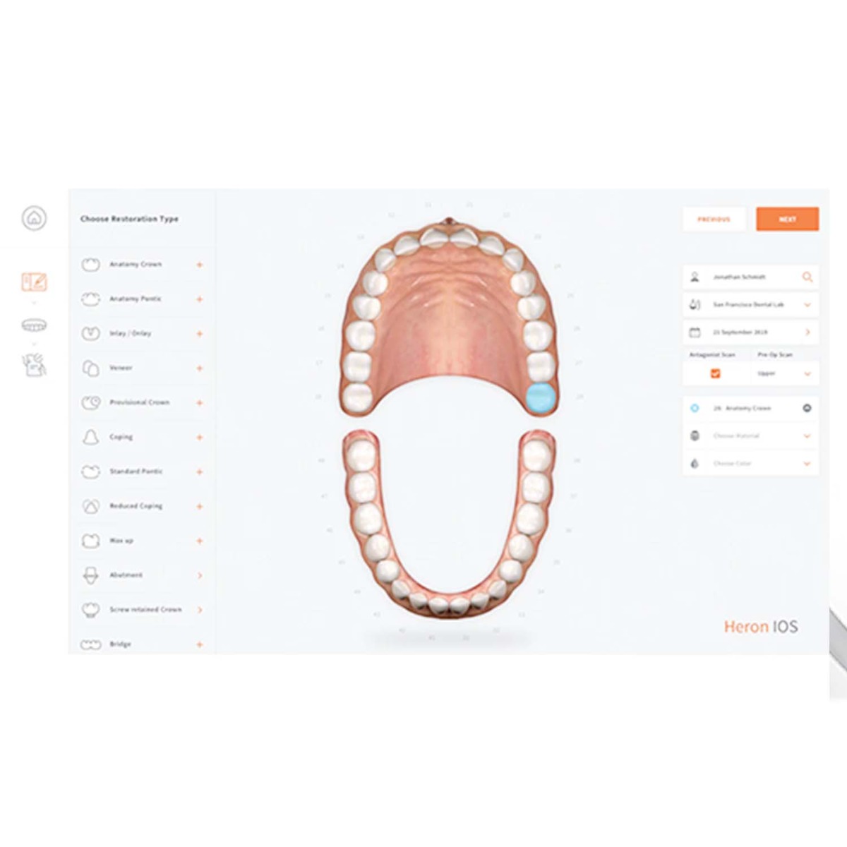 Heron Intraoral Scanner