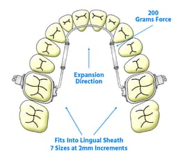 Ortho 