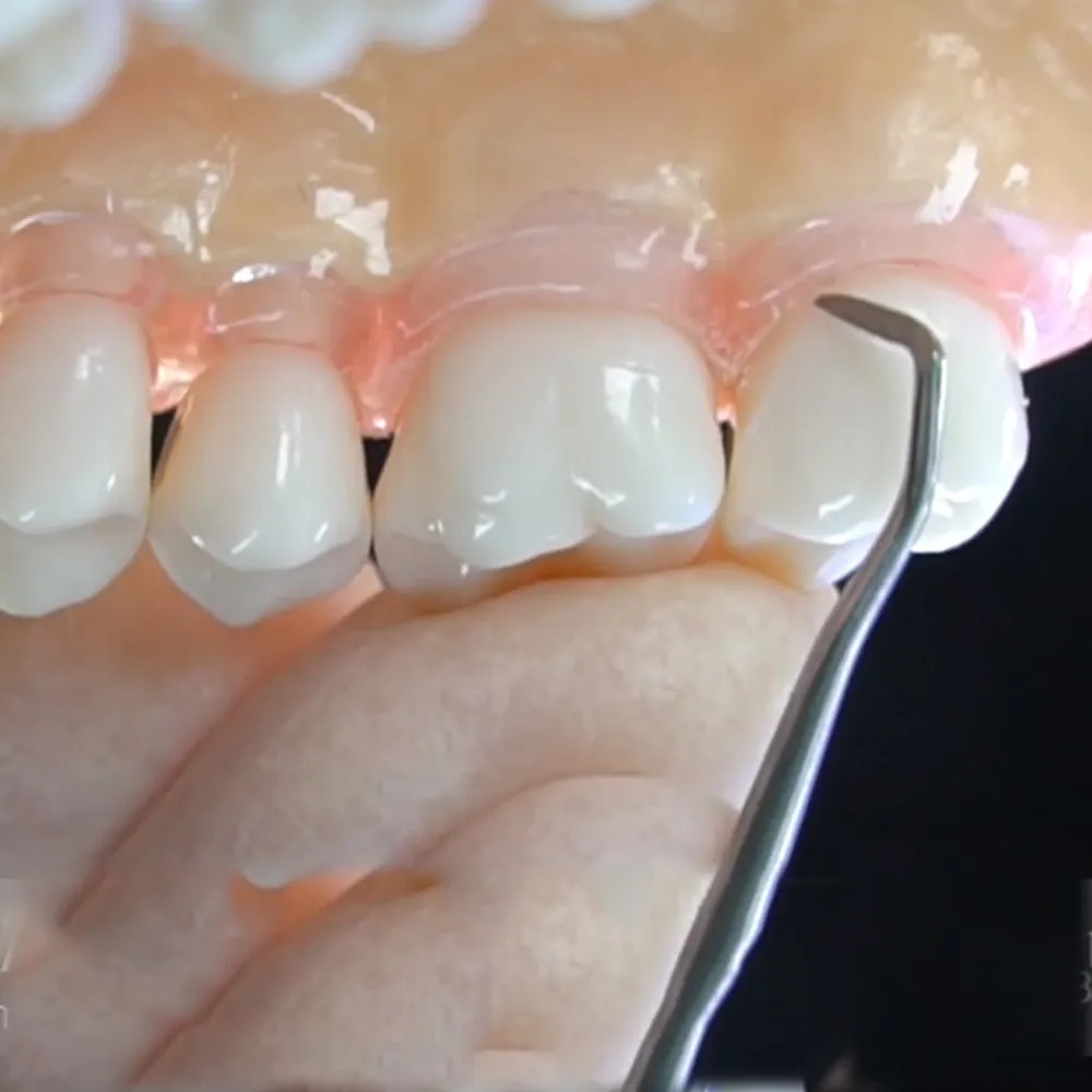 GDC Perio Scalers Set of 8 (PSP8)