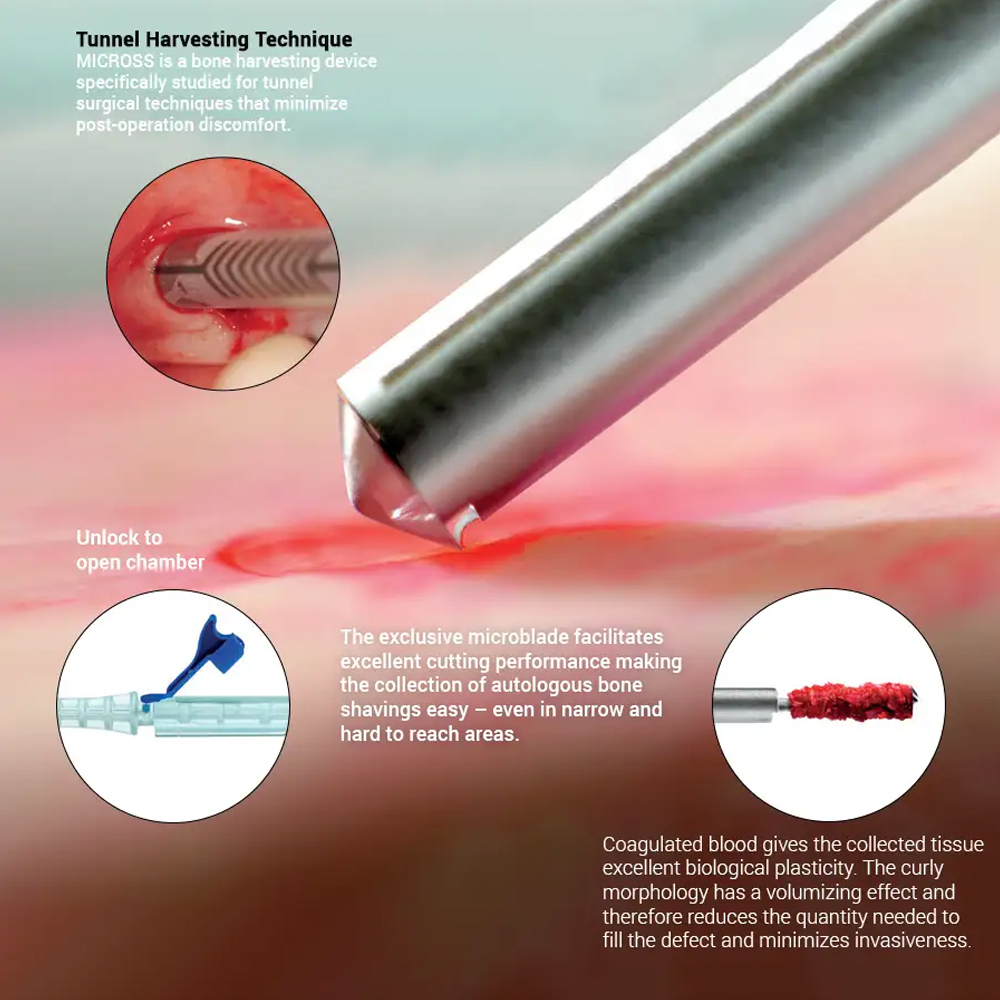 Geistlich Meta Safescraper