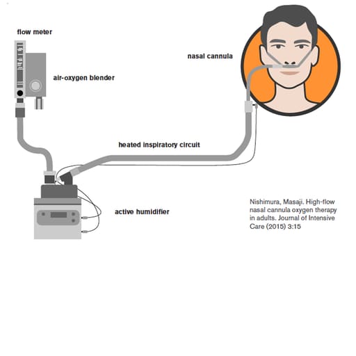 The 9192 Nasal Oxygen Cannula Nasal Cannula (Pack Of 1)