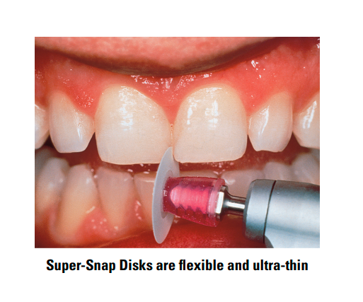 Shofu Super Snap Mini Kit CA