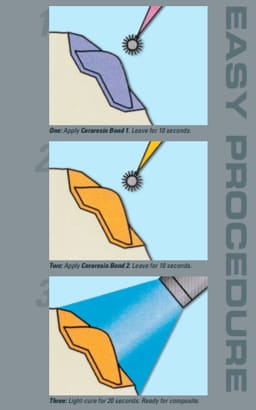 Shofu CeraResin Bond Set - 5