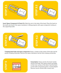 Kids-e-Dental Bands with tube attached Refills - 5