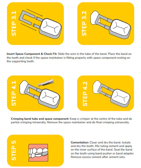 Kids-e-Dental Bands with tube attached Refills