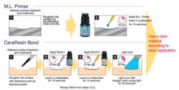 Shofu P & R Repair Kit - 3