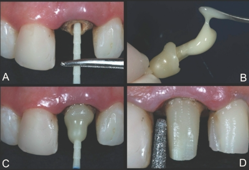 Medicept Dental Artiz