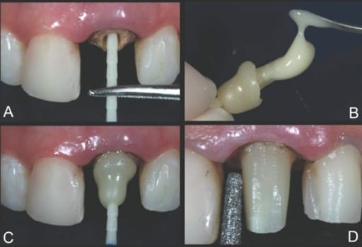 Medicept Dental Artiz