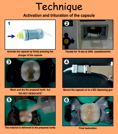 Prevest Denpro Micron Superior Capsules (30010-3)