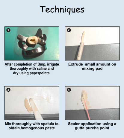 Prevest Zical Automix