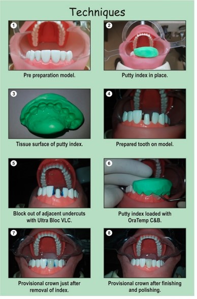 Prevest Denpro Oratemp C&B