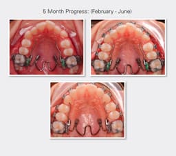 Ortho 