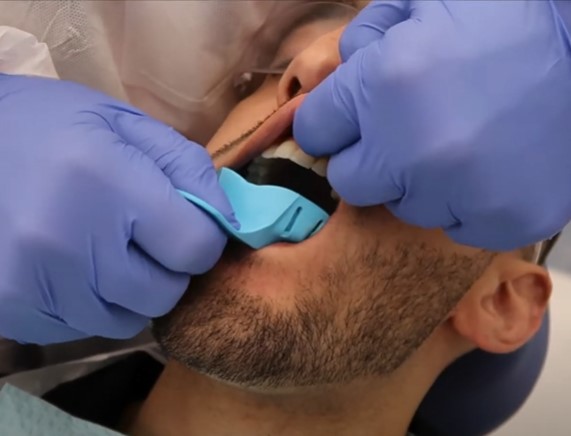 Cotisen Autoclavable Impression Trays (Set of 10)