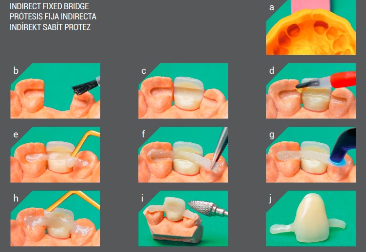 Angelus Interlig Single Patient Strip