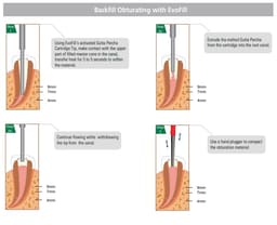 Diadent EvoFill Gutta Percha Cartridges - 3