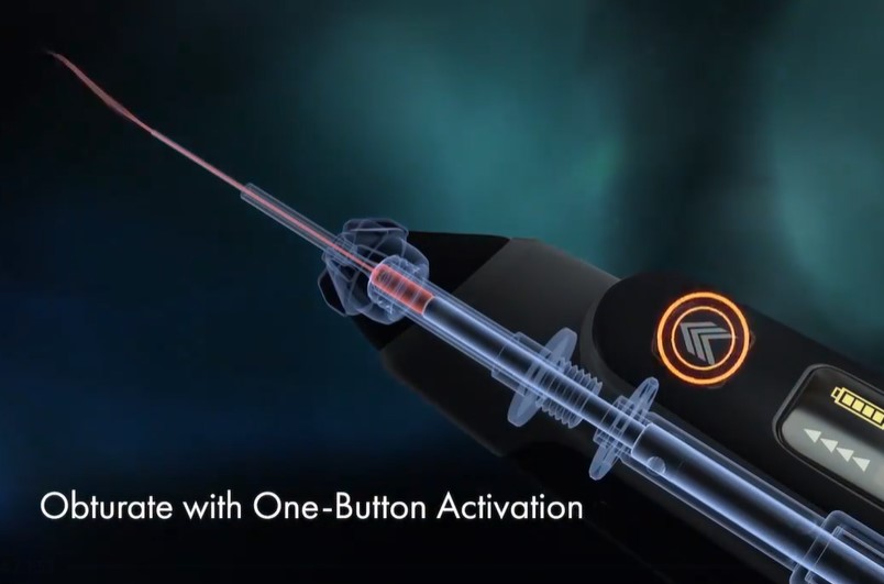 Diadent EvoFill Gutta Percha Cartridges