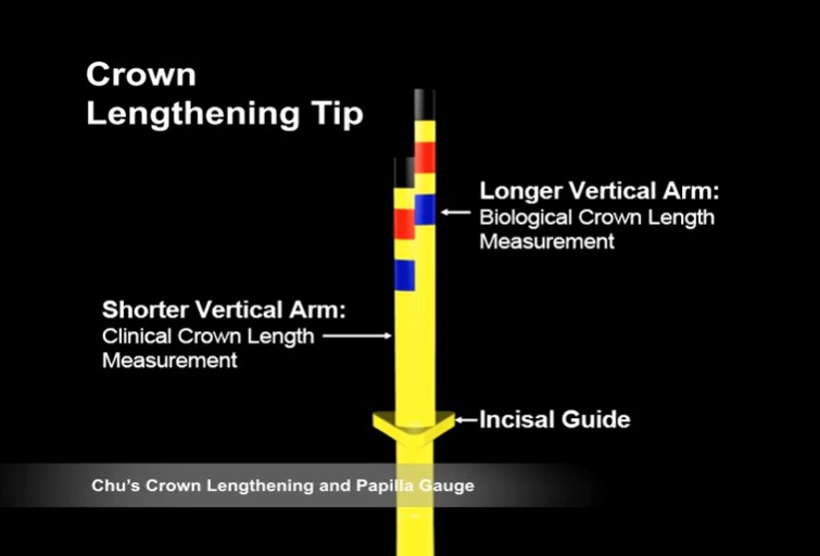 Hu-Friedy Chu'S Crown Lengthening Gauge (CLG)