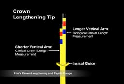 Hu-Friedy Chu'S Crown Lengthening Gauge (CLG) - 6