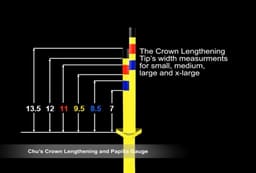 Hu-Friedy Chu'S Crown Lengthening Gauge (CLG) - 8