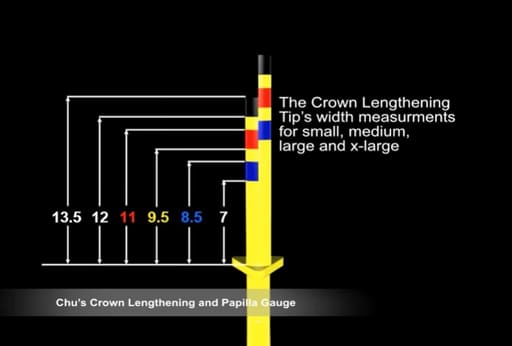 Hu-Friedy Chu'S Crown Lengthening Gauge (CLG)