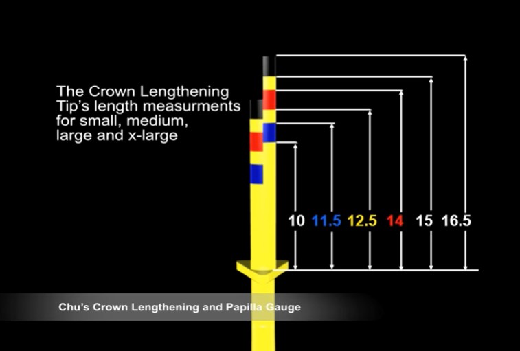 Hu-Friedy Chu'S Crown Lengthening Gauge (CLG)