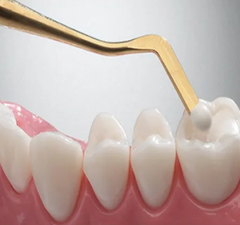 Oracraft Composite Instrument Gold Titanium Set Of 6 In Pouch - CIGS6