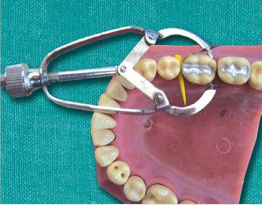 Hahnenkratt Matrix Bands