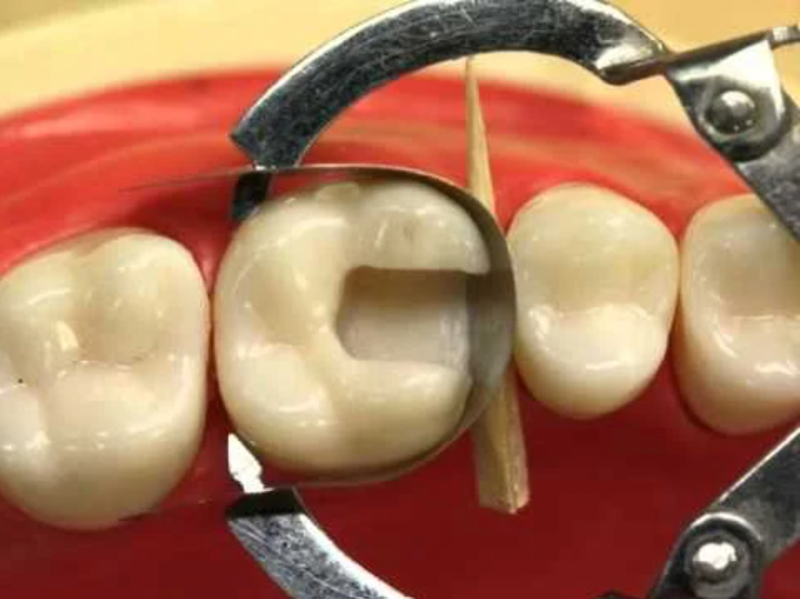 Hahnenkratt Matrix Bands