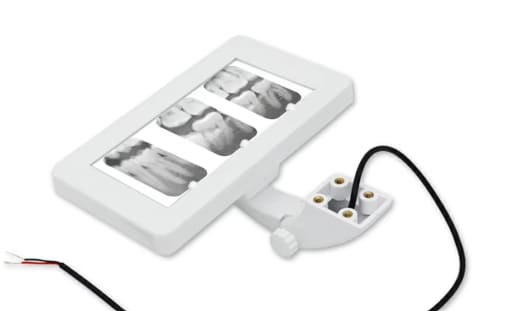 Sparedent IOPA Xray Viewer - Chair Mount