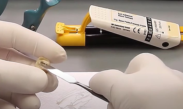 3M ESPE Relyx U200 Self-Adhesive Resin Cements