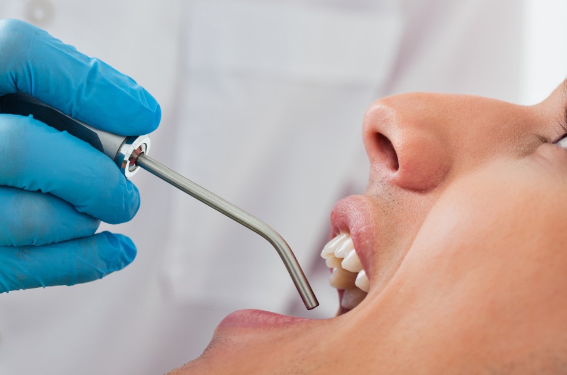 GDC Metal Suction Tip (3.0mm) (Aspct4)