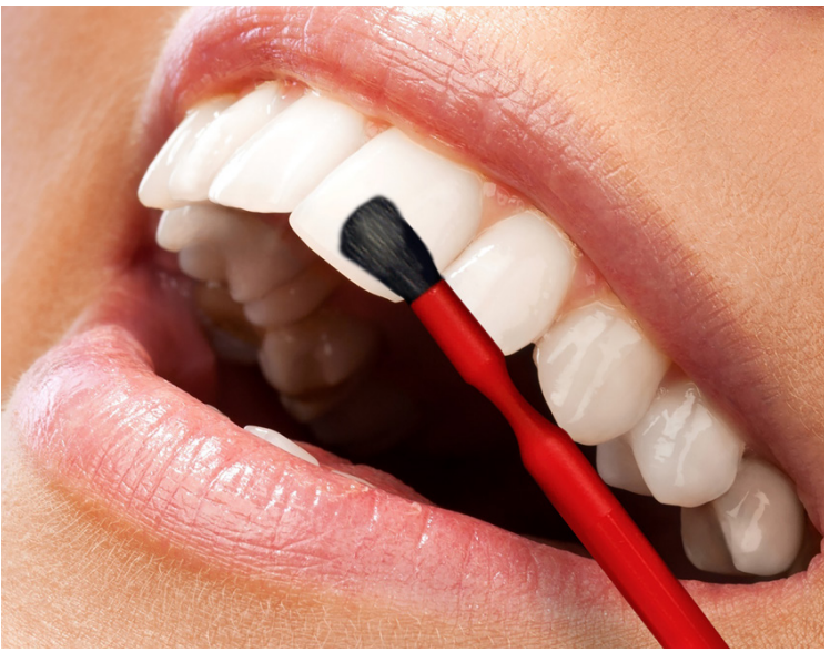 Centrix FluoroDose Sodium Fluoride Varnish Single Dose      