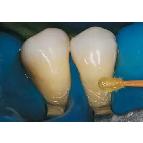 FGM Ambar Universal APS Bonding Agent 5ml