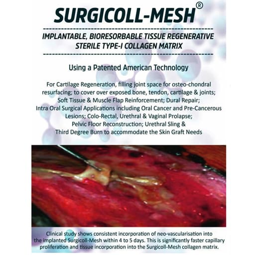 Advanced Biotech Surgicoll Mesh