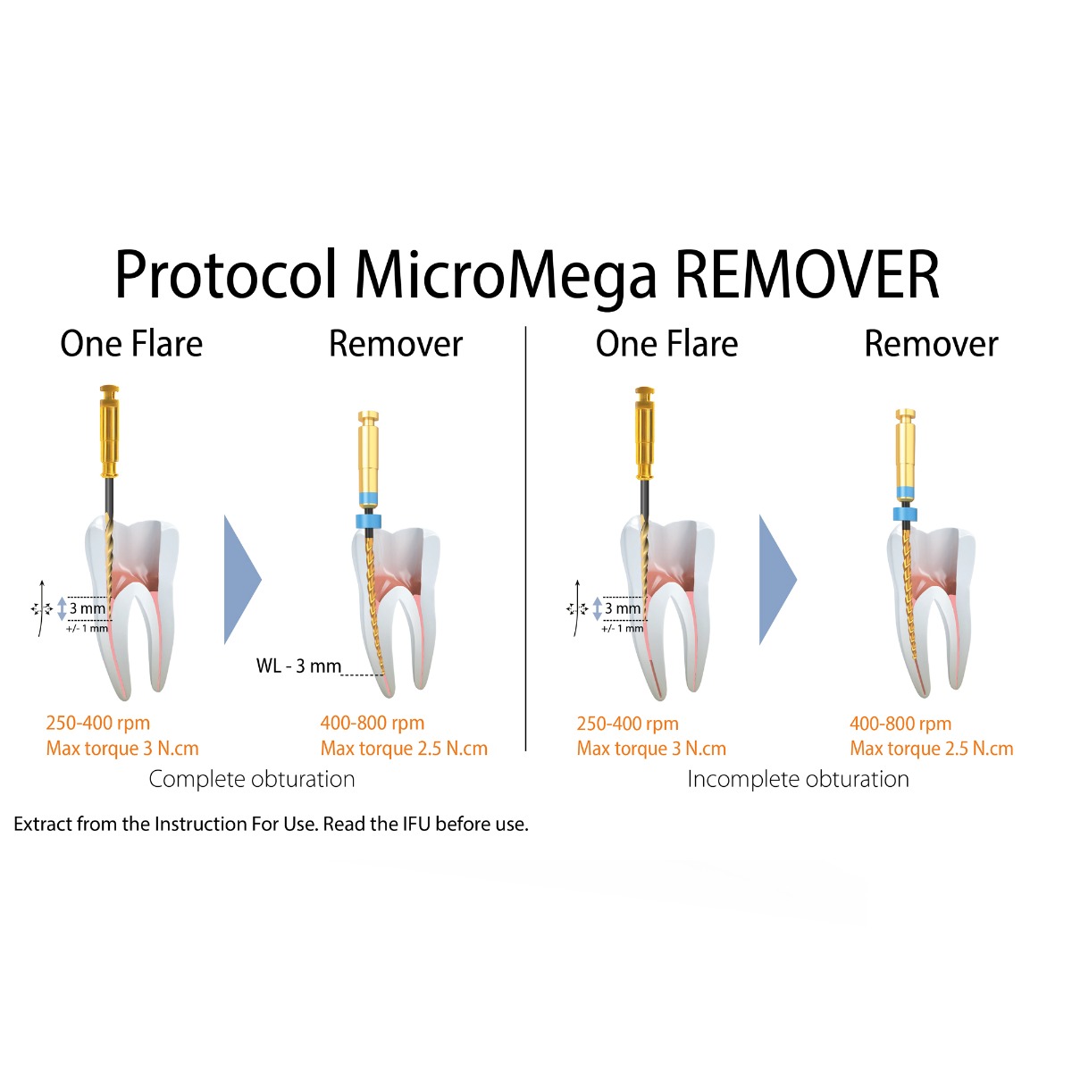 Micro Mega Retreat Retreatment Files 