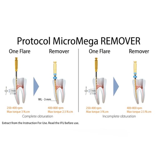 Micro Mega Retreat Retreatment Files