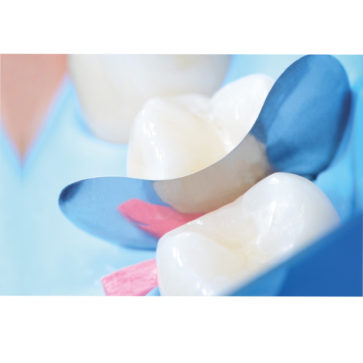 Polydentia QuickmatFLEX Sectional Matrices