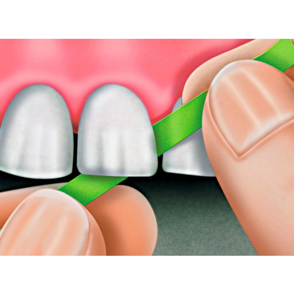 Polydentia Abrasive Polishing Strips