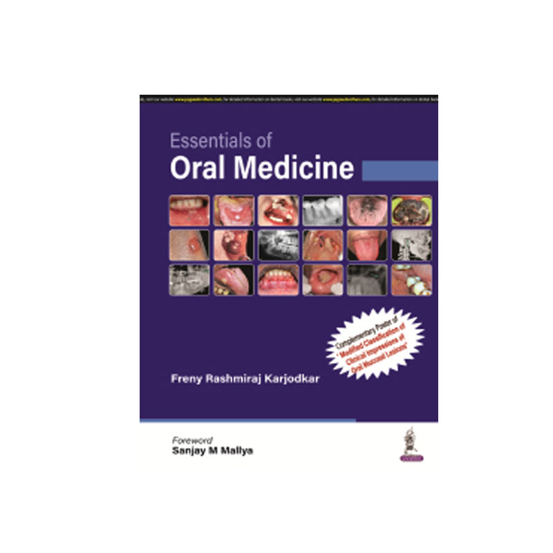 Jaypee Medical Essentials of Oral Medicine (ISBN - 961739)