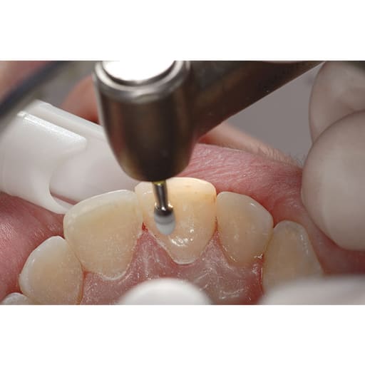 ET Dental Composite Finishing & Polishing Kit FG