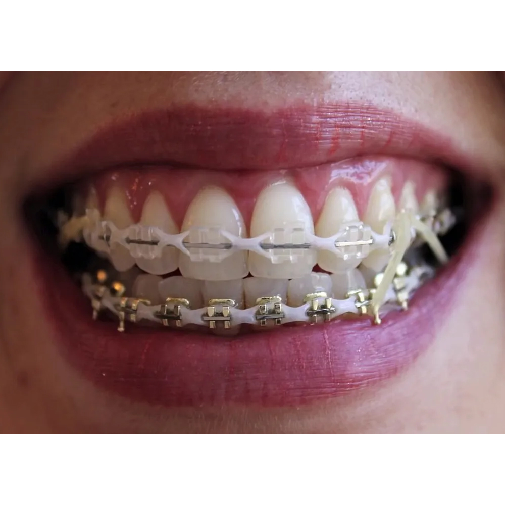 Prime Ortho Elastic Chains Short 10ft