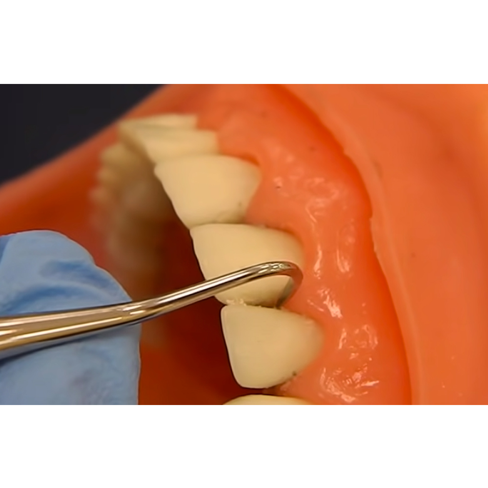 GDC Sickle Scalers Anterior #6 (Sn137)