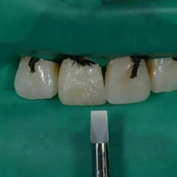 HN Dental Composite Silicone Brushes Set Of 5 - 9